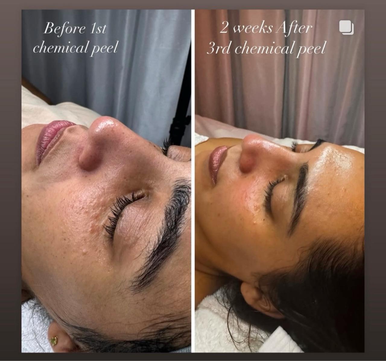 Simply Facials gallery photograph 46